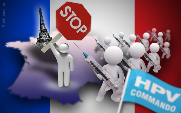 HPV: Franciaországban is meghúzták a vészharangot